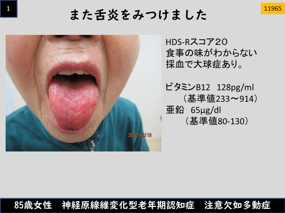 ダイエット 21 03 11 ダイエット