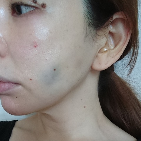BeautyPlus_20180521160359411_save