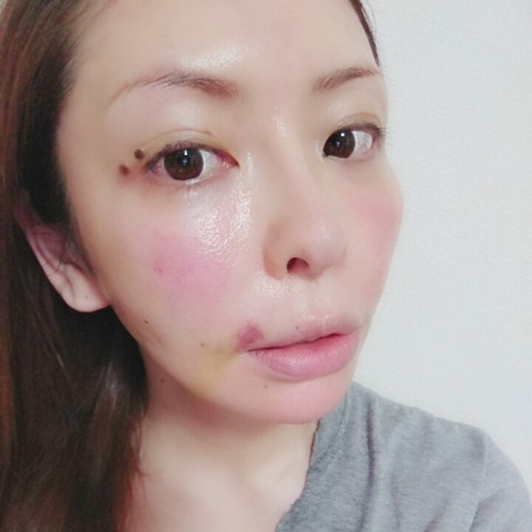 BeautyPlus_20180823232216676_save