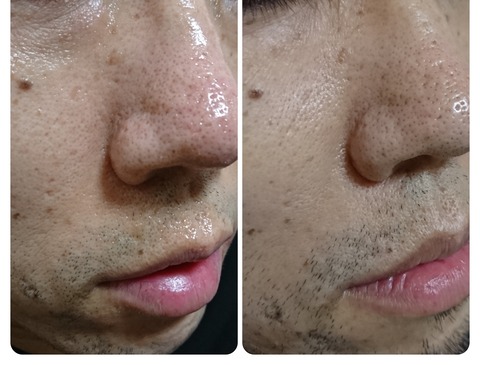 BeautyPlus_20200310020844048_save