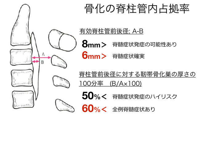 靭帯骨化症 頚椎後縦靭帯骨化症 と診断された方へ とぜんな脊椎外科医のブログ