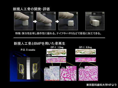 HAp/Col、Refit®の適切な使用方法について