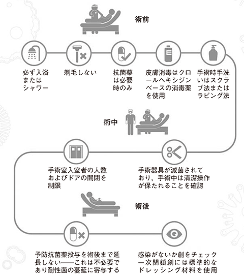 手術部位感染症の予防について