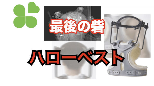 ハローベスト とぜんな脊椎外科医のブログ