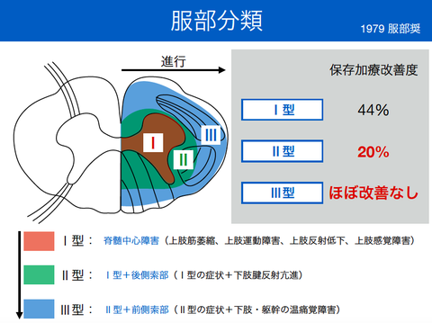 頚椎症の進行。判断に重要な服部分類とは。