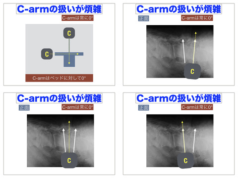 重要なポジションであるC-arm係！最高のチームをつくれ！