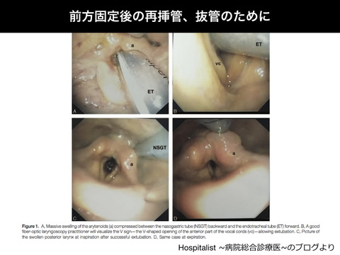 ところでカフリークテストって？