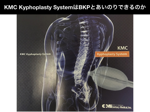 KMC Kyphoplasty SystemはBKPにあいのりできるのか！？