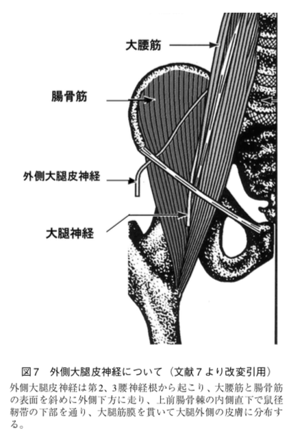 絞扼性末梢神経障害を鑑別しよう。大腿の感覚異常、meralgia parestheticaについて