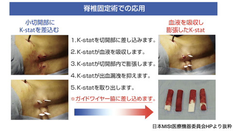 2021とぜん.003