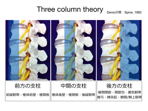 椎体破裂骨折、胸腰椎損傷についての分類と考察