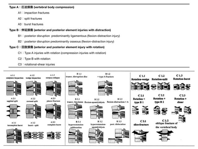 AO脊椎外科マニュアル