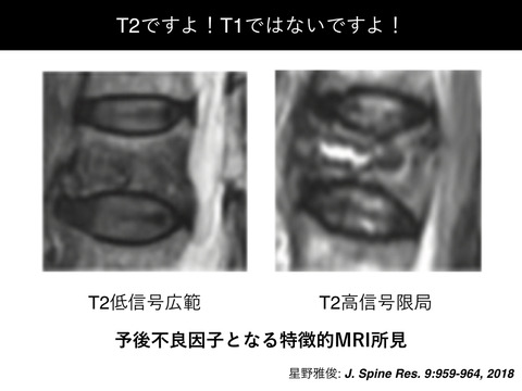 MRIで予後不良因子を持つ骨粗鬆症性椎体骨折には早期BKP介入が有効