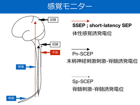 感覚誘発電位、SEPについて