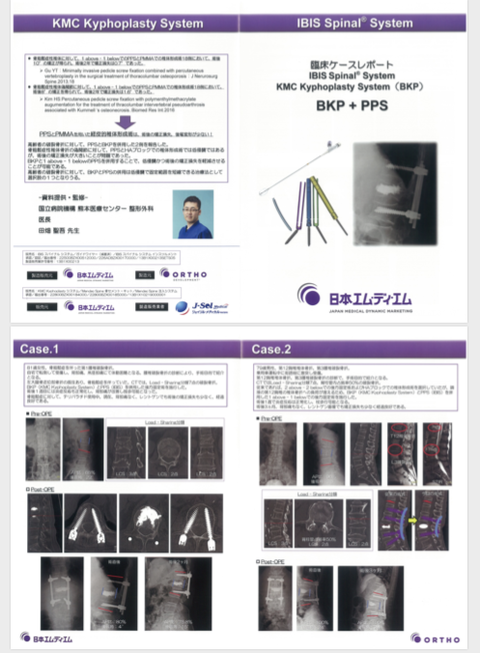 BKP+PPS治療の可能性