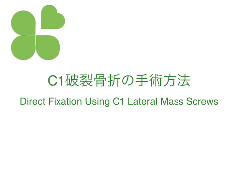 C1破裂骨折の手術方法、Direct Fixation Using C1 Lateral Mass Screws