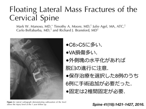 floating lateral mass.005