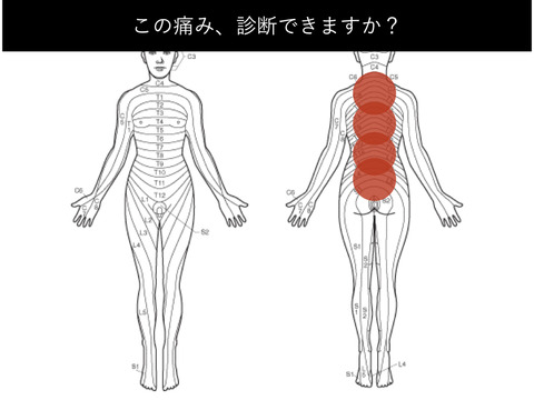 この腰痛の原因、わかりますか？？