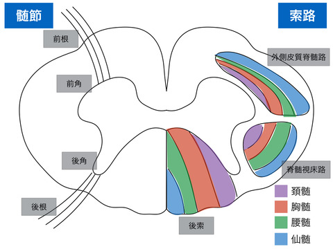 脊髄梗塞の病型