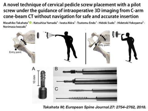 C-arm cone-beam CTを使ってナビなしで頚椎椎弓根スクリューを適切に入れる方法がある！！