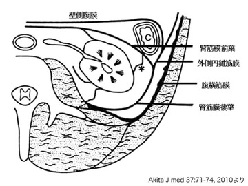 出張XLIF、後腹膜腔の理解がまだまだ