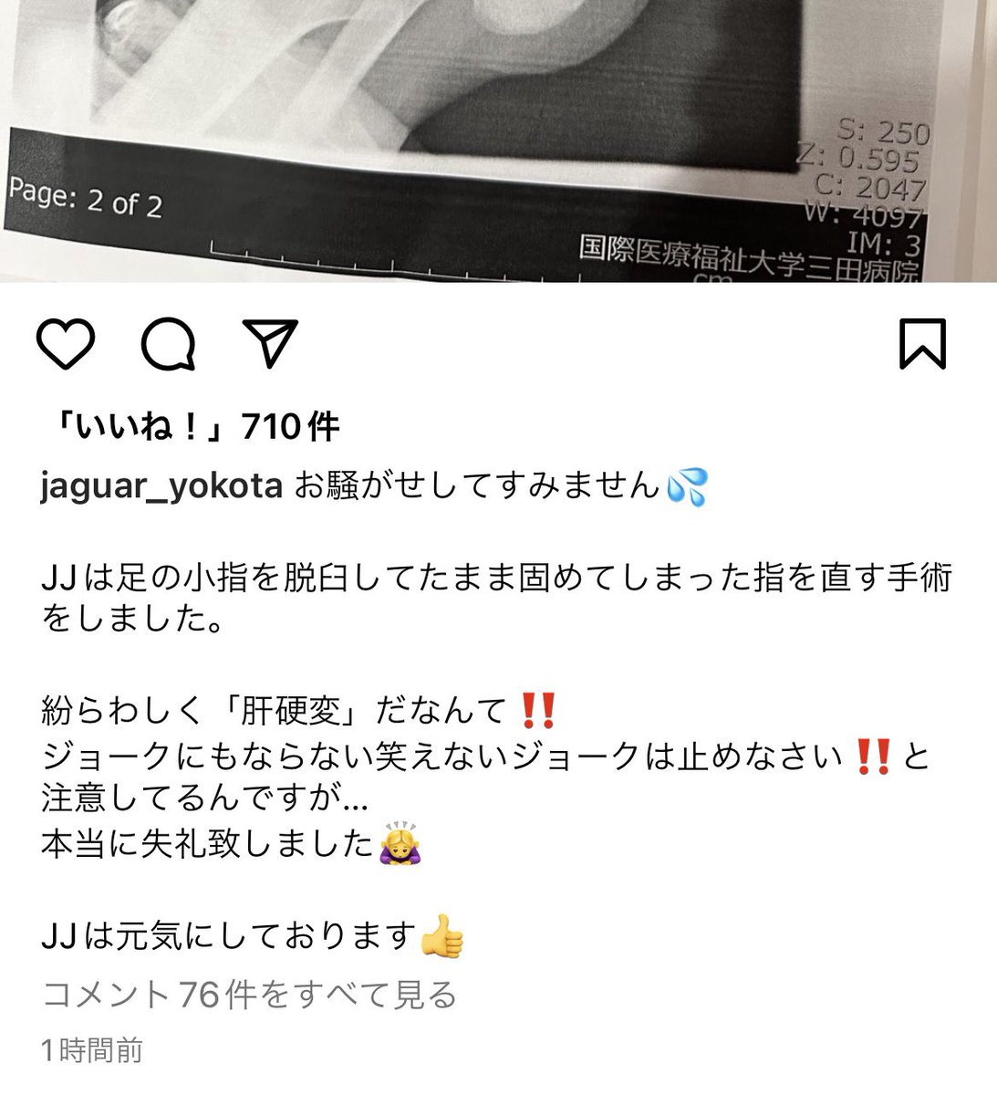 【は？人騒がせな！】ジャガー横田長男「肝硬変の手術」告白はジョークだった　実際は「脱臼して固まった足の小指を治す手術」で母親が謝罪  [muffin★]