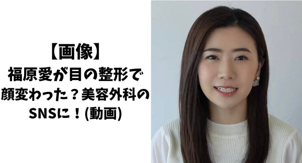 福原愛が整形をカミングアウト!? 激変した姿を公開で大反響「顔が違う」  [ネギうどん★]