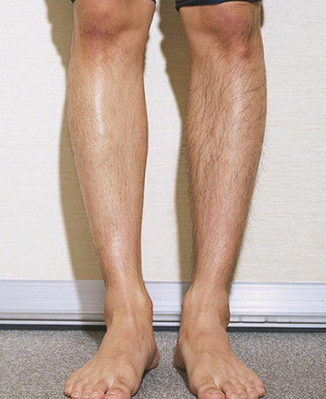 短パン男性は、すね毛を剃るべきなのか？「すね毛キモい」「汚くて不快」、「気にならない」擁護派も