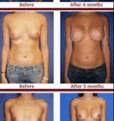 ���������äѤ��ӡ��ե����ե��� [����]