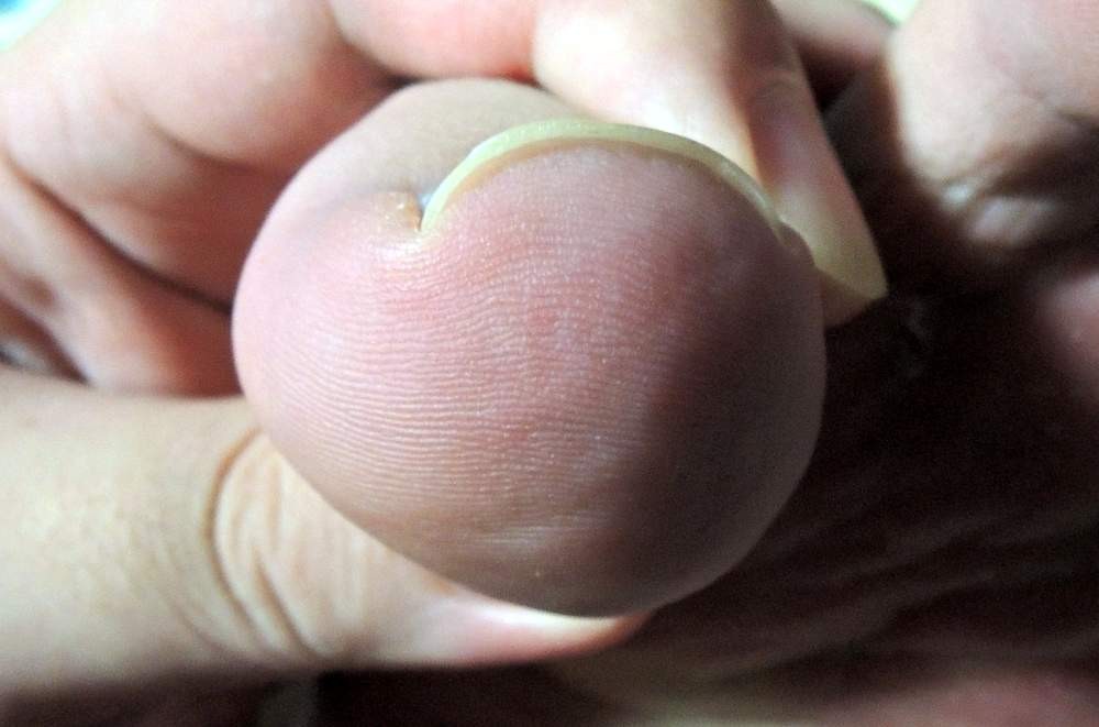 巻き爪には ニッパー型の爪切り が良い 軽度な 巻き爪だけど 新しい爪切りを検討中 何でも雑記板 新