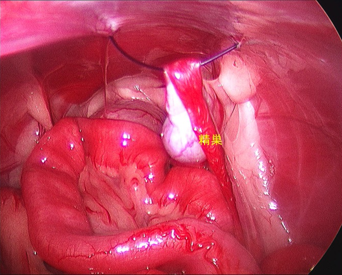 腹腔鏡下による腹腔内潜在精巣 陰睾 停留睾丸 摘出術 藤井寺動物病院 病院日誌