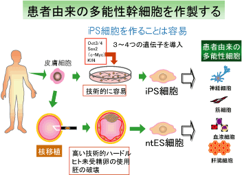 で Ips細胞って何の略 エフフィールドブログ
