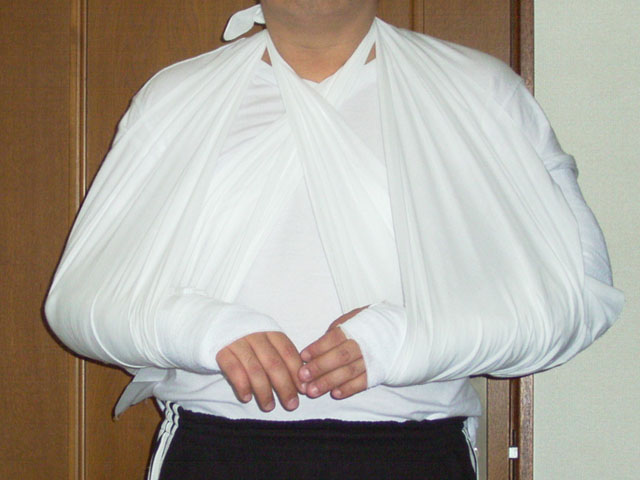 両腕骨折 D ヽ Fukaの物欲馬鹿一代 笑 両腕骨折 D ヽ Fukaの物欲馬鹿一代 笑