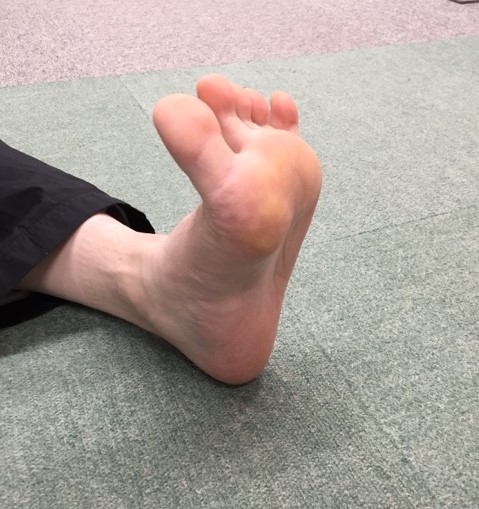 簡単実践 毎日の足指トレーニングで足裏が強くなる ソフトテニス オンライン 簡単実践 毎日の足指トレーニングで足裏が強くなる ソフトテニス オンライン