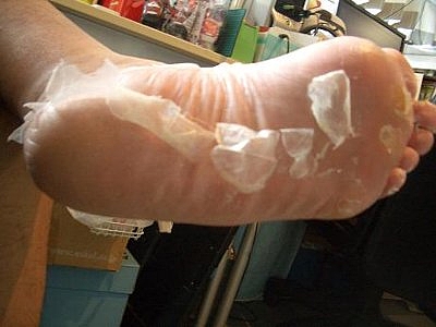 話題沸騰角質ケア ベビーフット 爆笑体験記 その3 Nicheee ニッチー テレビリサーチ会社がお届けする情報サイト 話題沸騰角質ケア ベビーフット 爆笑体験記 その3 Nicheee ニッチー テレビリサーチ会社がお届けする情報サイト