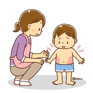 child_eczema_soft