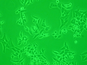 HeLa_cells (1)