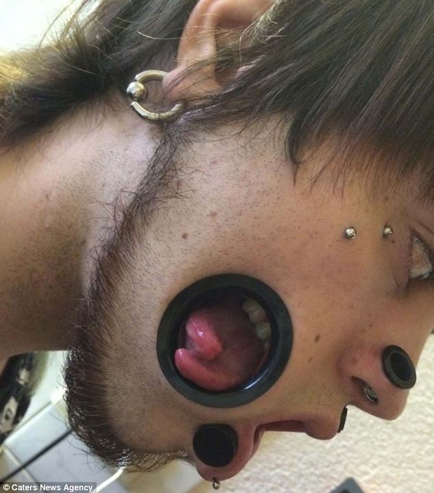 閲覧注意 ほっぺたに大きな穴を開けた青年 画像あり ガハろぐnewsヽ W ズコー 閲覧注意 ほっぺたに大きな穴を開けた青年 画像あり ガハろぐnewsヽ W ズコー