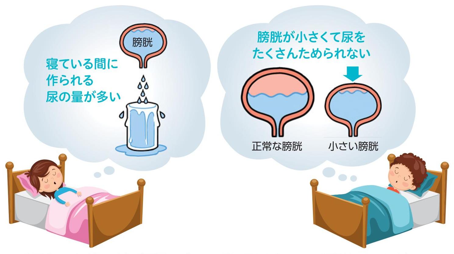 マ○コさん　最近“おねしょ”していることを告白
