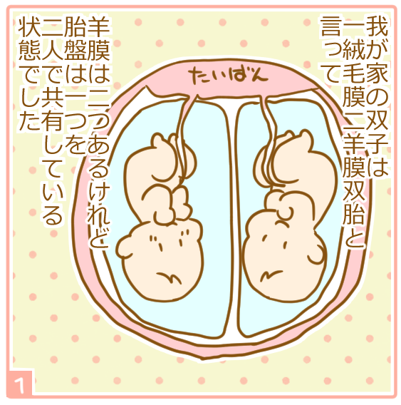 双子妊娠⑭体重差が心配1