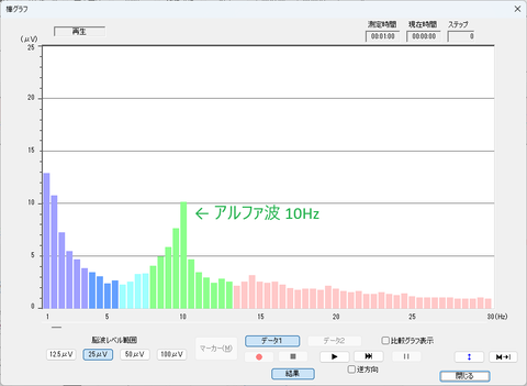 脳波 After コメント入り