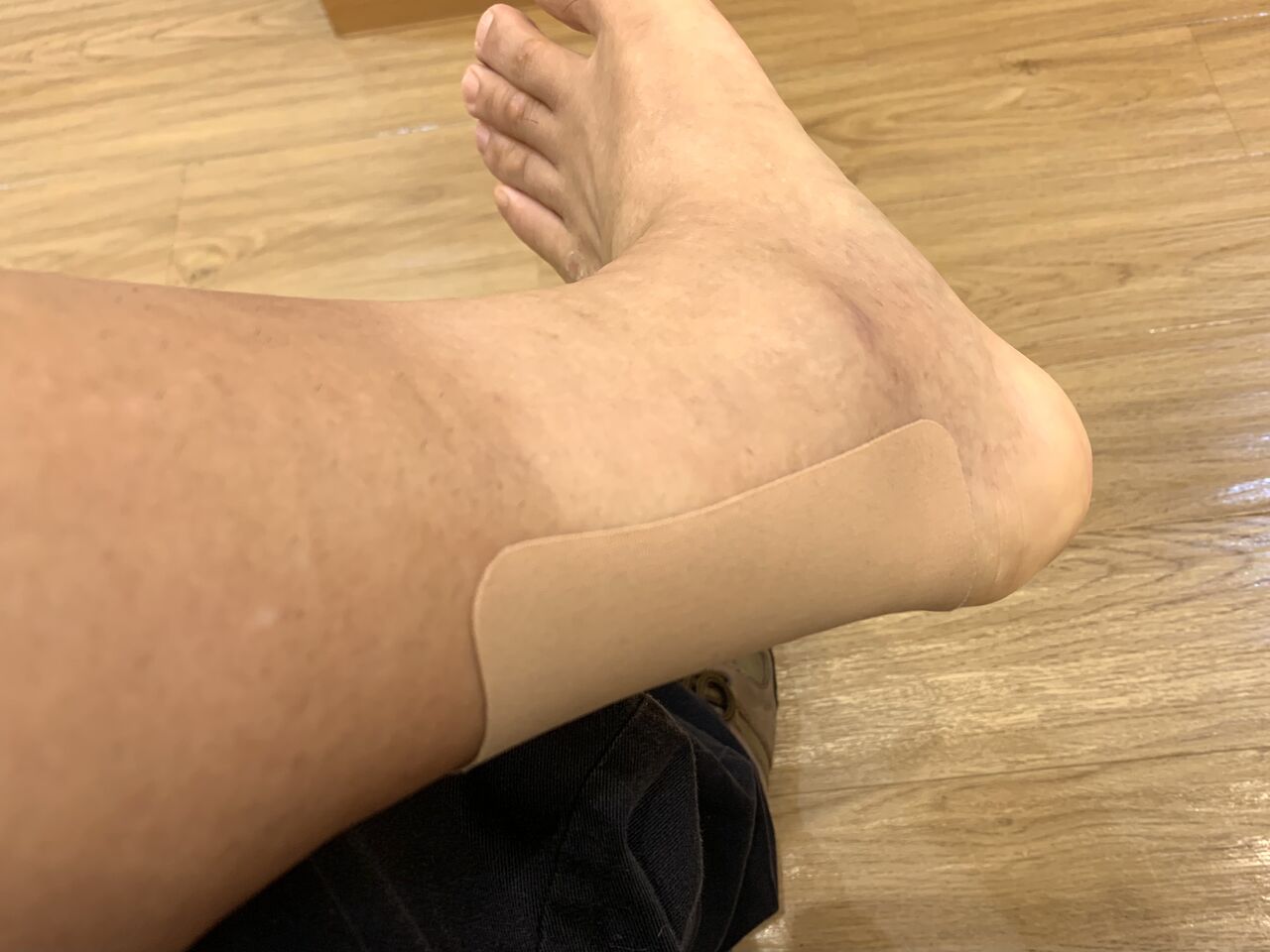 腓骨骨折は完治なんだけど ふつうのパパ の部屋