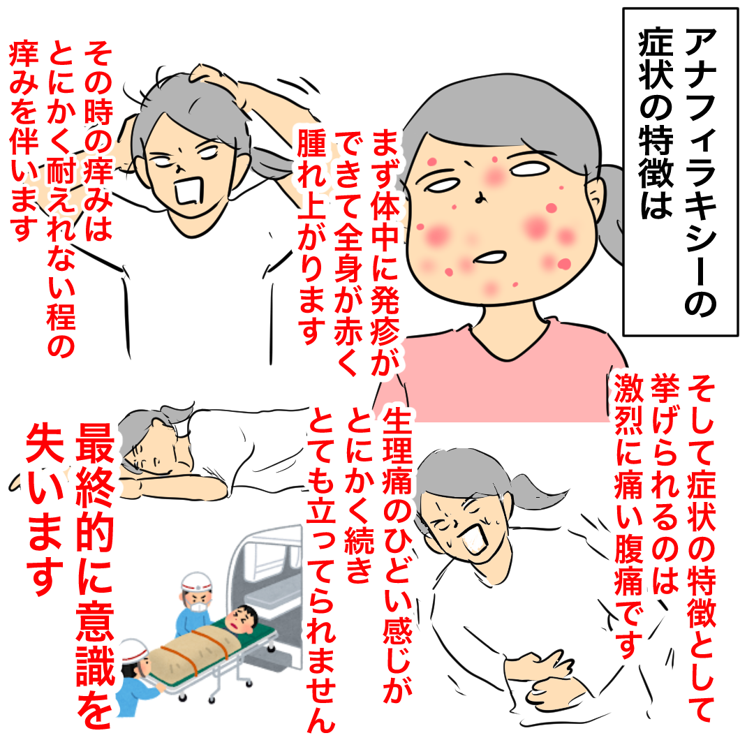 運動 誘発 アナフィラキシー