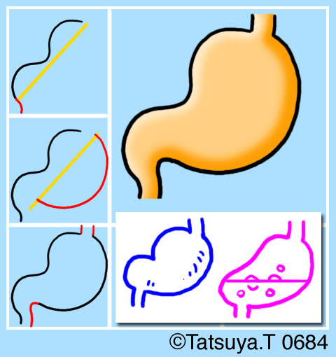 斉藤コミュ絵 Livedoor Blog ブログ 斉藤コミュ絵 Livedoor Blog ブログ