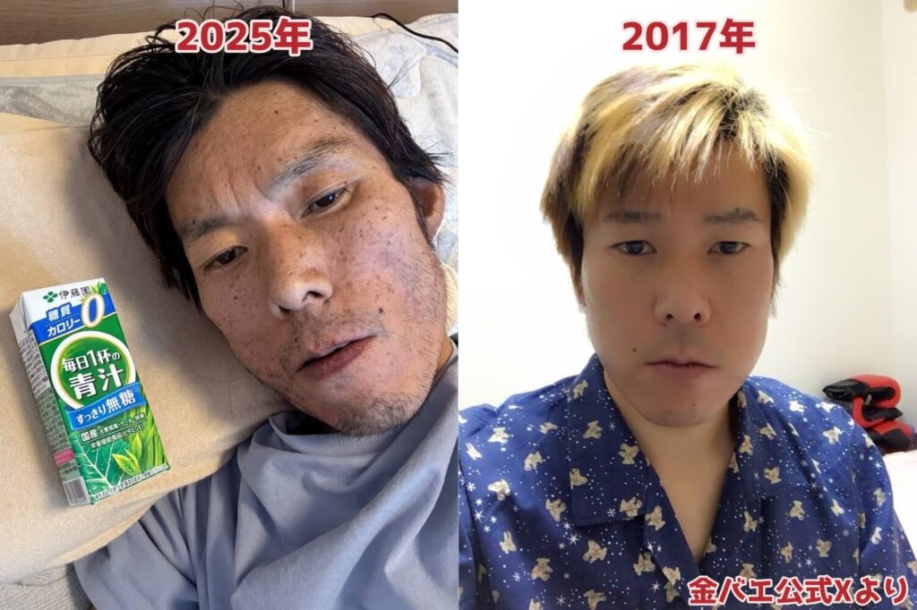 【生きてんの？】元祖迷惑系”金バエ”に警察出動！横領の疑い”四ツ谷警察署”