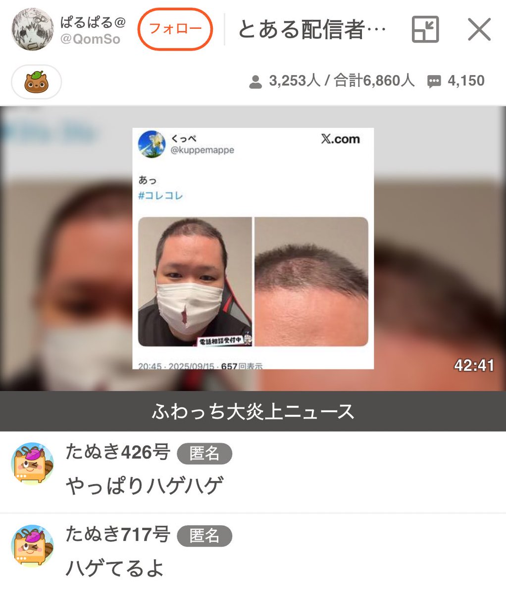 【頭頂部】コレコレを叩くのはいい...但しハゲをバカにするな！！