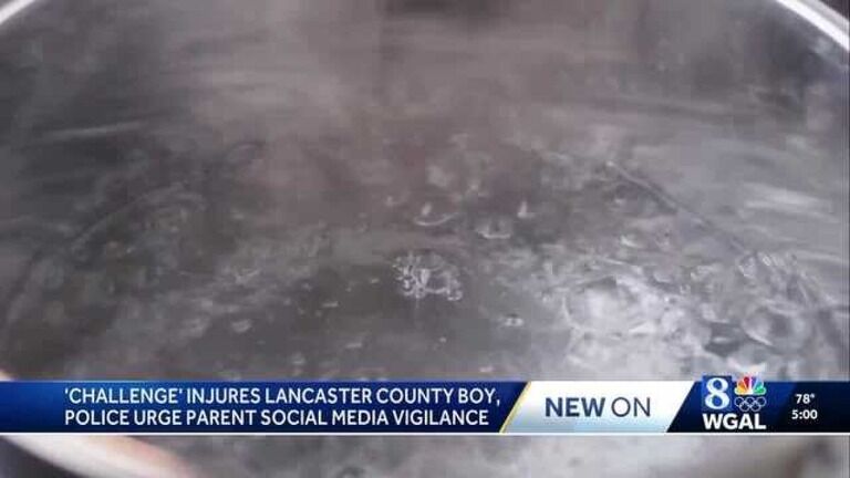 【炎上】米国で大流行「熱湯チャレンジ」…9歳児が大火傷「ドッキリで熱湯かけただけだよ」