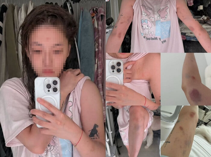 【炎上】女性配信者、自称中国人の韓国人から暴行受ける「アイアムチャイニーズ…ニダ？」