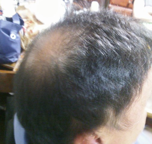 衝撃の禿げ画像 新 ある業界人 の1日 衝撃の禿げ画像 新 ある業界人 の1日