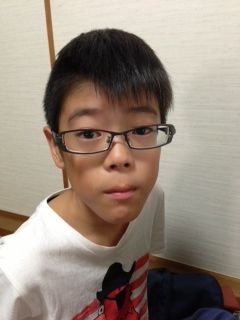最高の画像 新しい 未熟児 顔 特徴 最高の画像 新しい 未熟児 顔 特徴